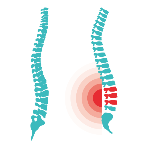 Ortho and Spine Physiotherapy Treatments Clinic in Greater Noida